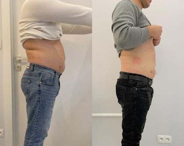 metamorfoza Wellclinic