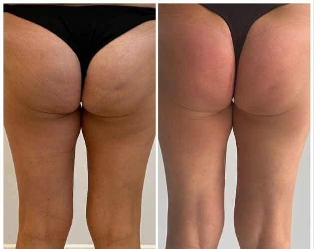 metamorfoza Wellclinic