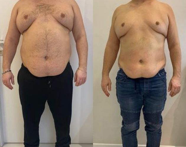 metamorfoza Wellclinic
