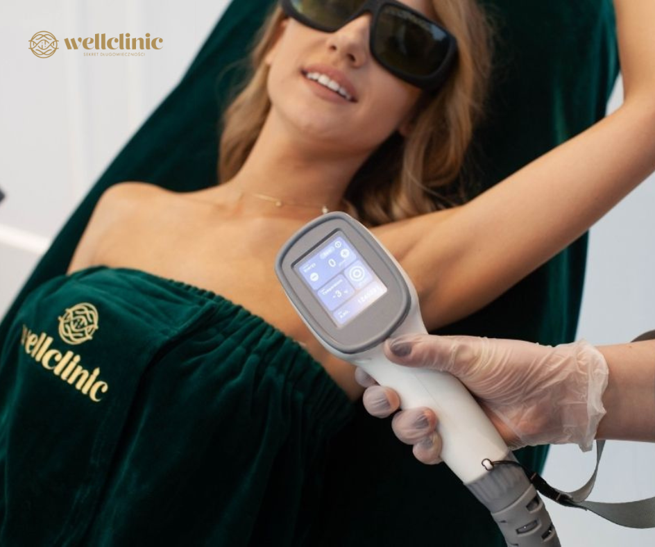Laser-Haarentfernungsbehandlung