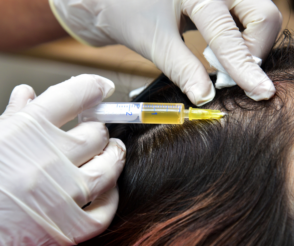 Behandlung von Alopezie