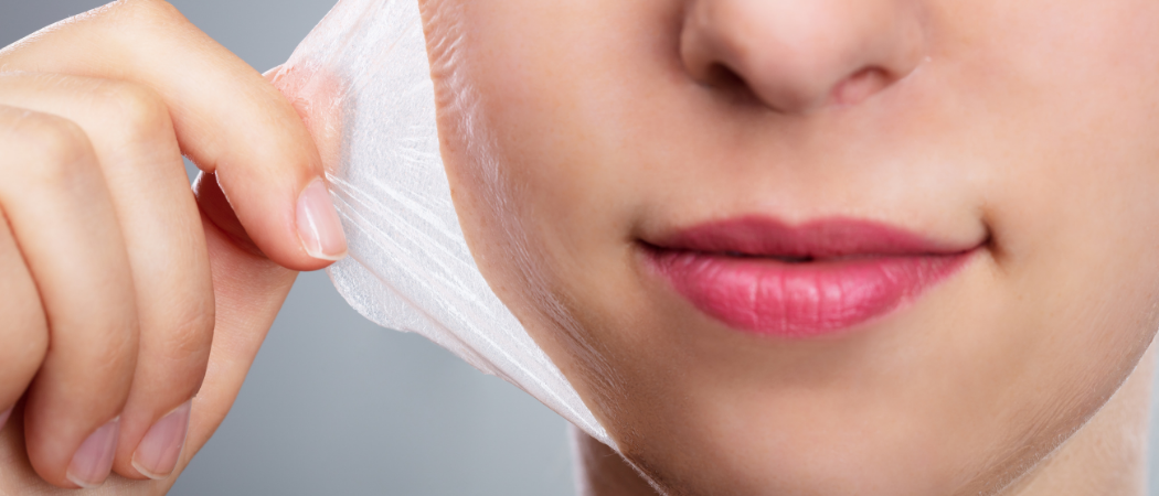Chemische Peelings in der Klinik Wellclinic