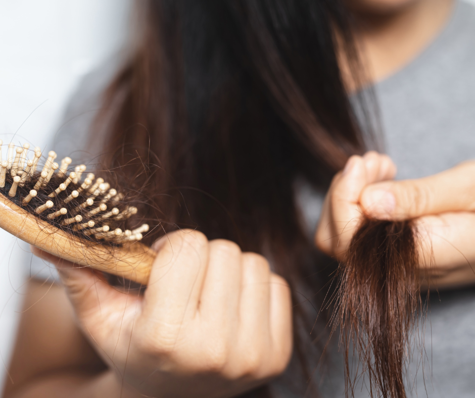 Alopecia etter fødsel