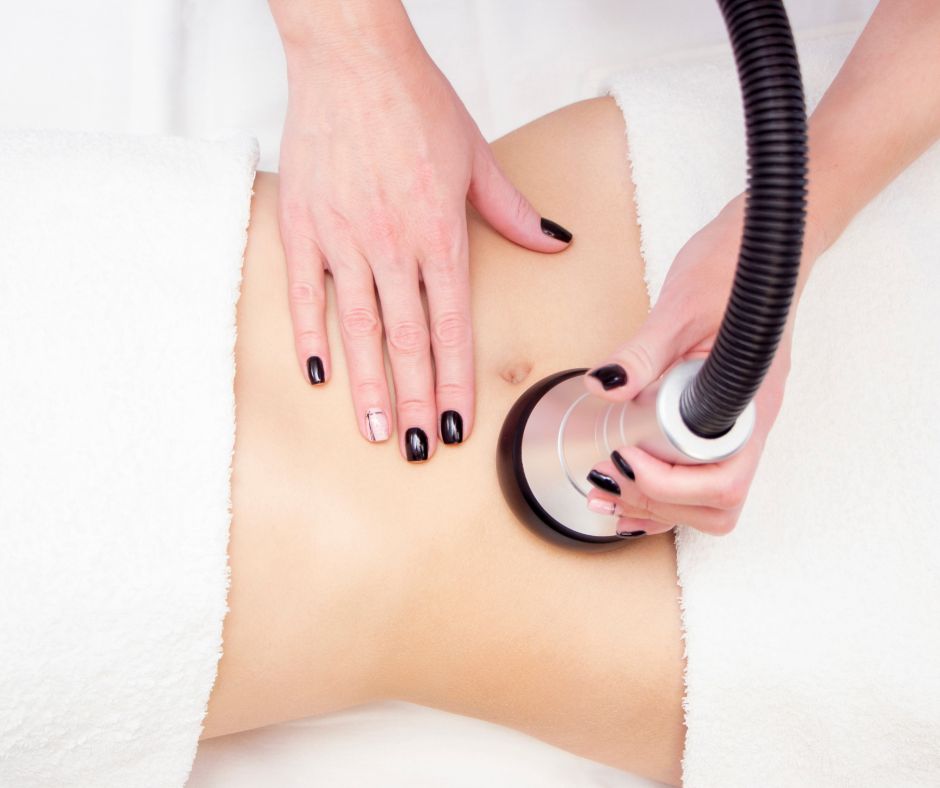 Laser-Liposuktion