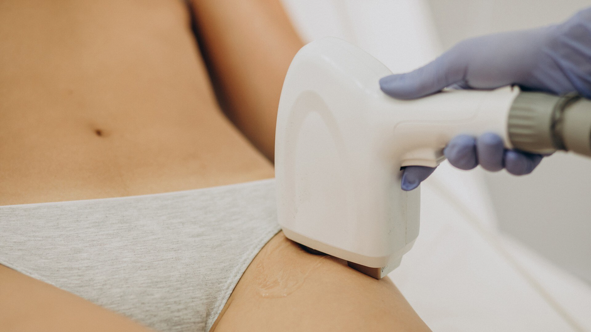 Bikini-Haarentfernung mit Laser