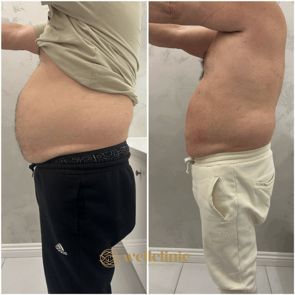 MetamorfoseVegttab