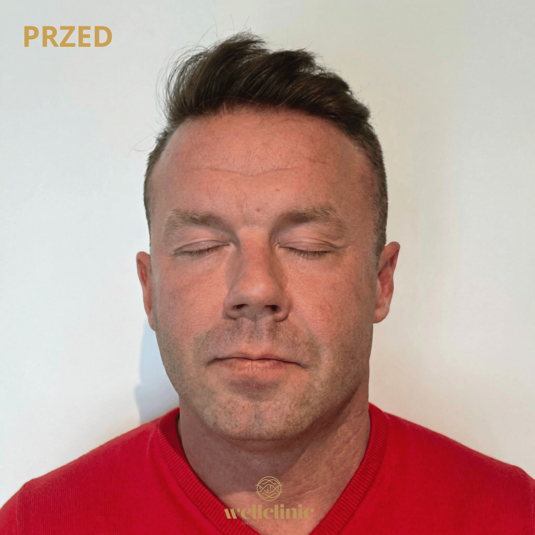Przed