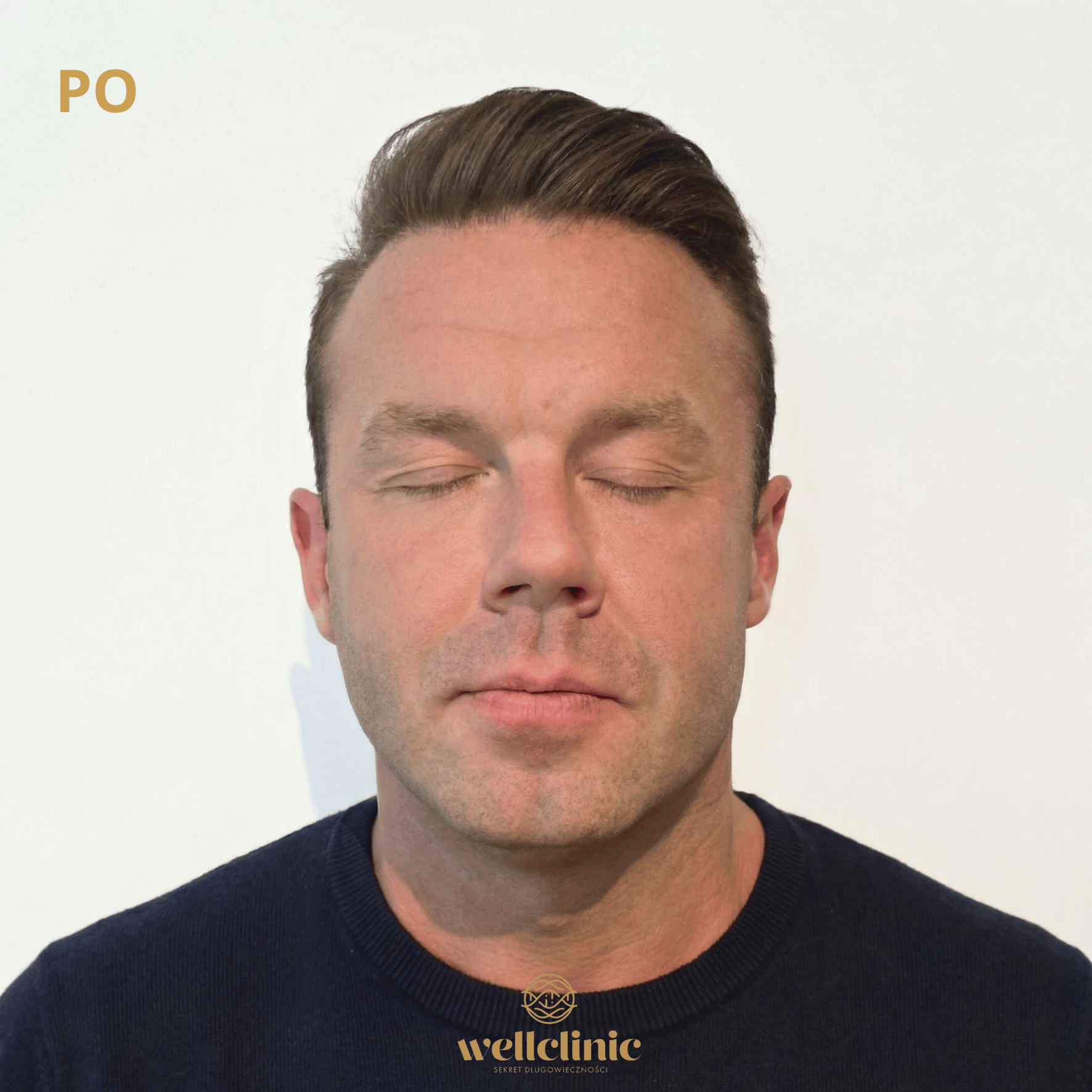 Po