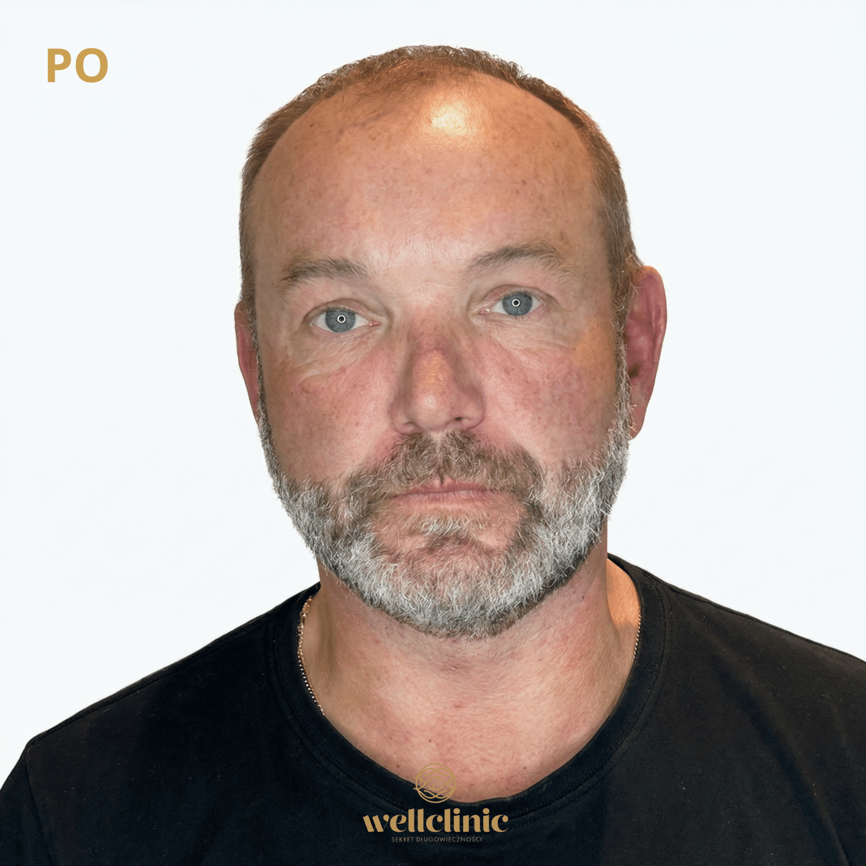 Po