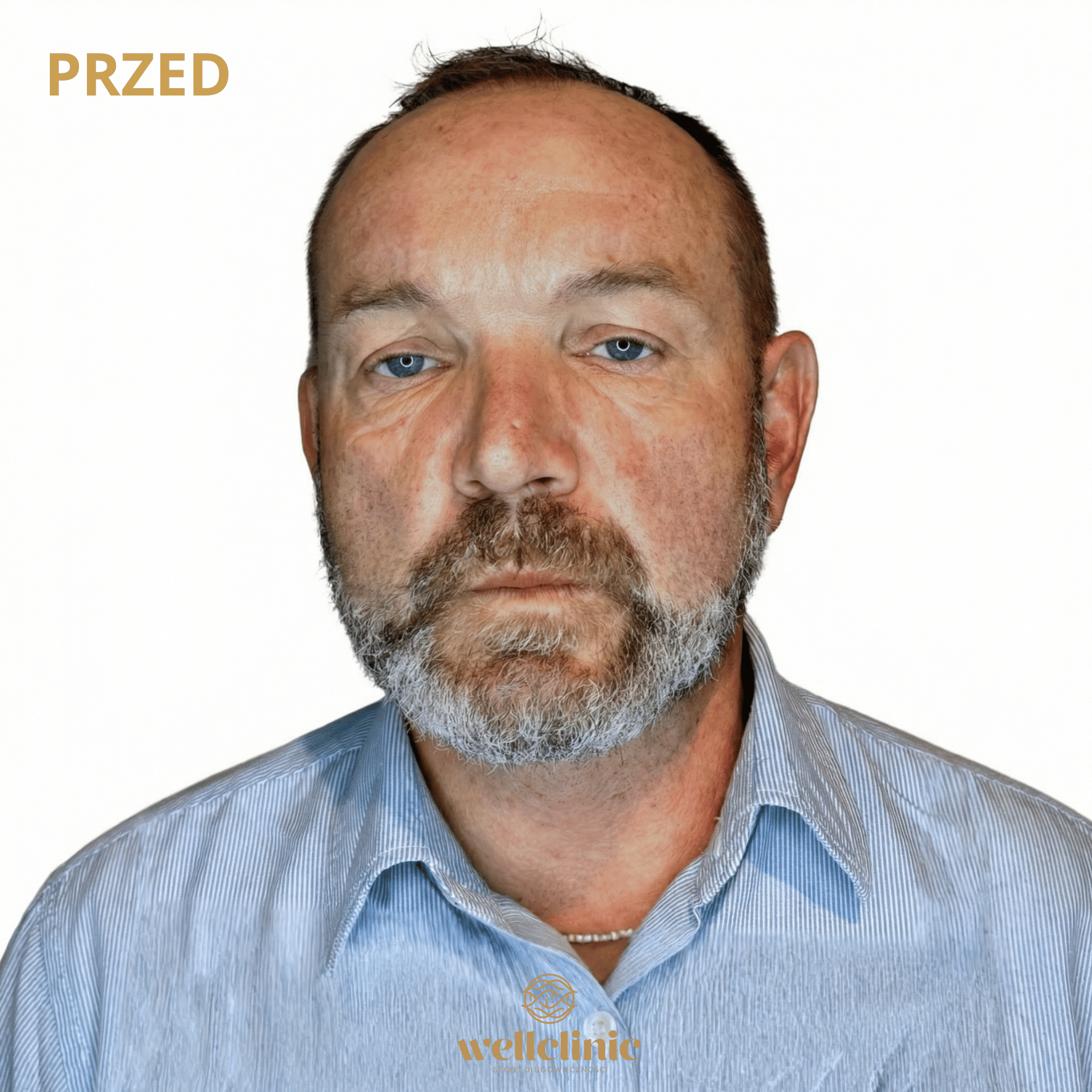Przed
